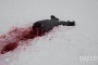 hypothermia (5)